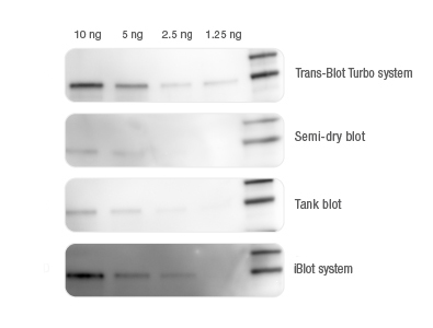 BIO-RAD Trans-Blot®Turbo美国伯乐全能型蛋白转印系统1704150